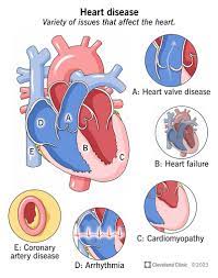 CHRONIC CARDIAC CONDITION MANAGEMENT