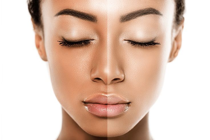 The Dangers of Skin Bleaching: Understanding the Risks