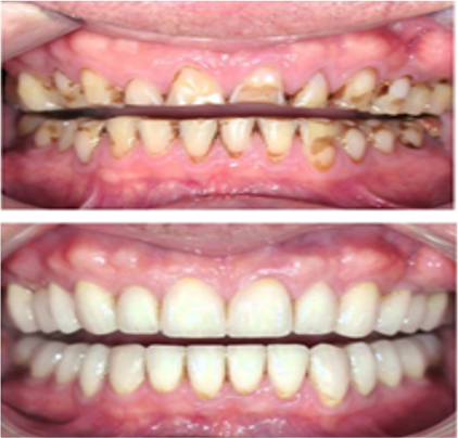 REHABILITACIÓN                                                                                                                                 ORAL