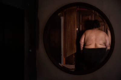 DKV muestra la fotografía del estigma de la obesidad