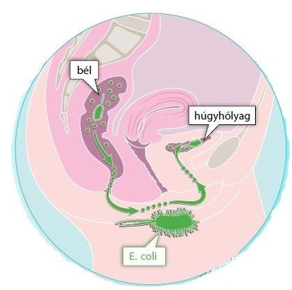 Kettős támadással az E.coli baktérium okozta fertőzés tünetei ellen.
