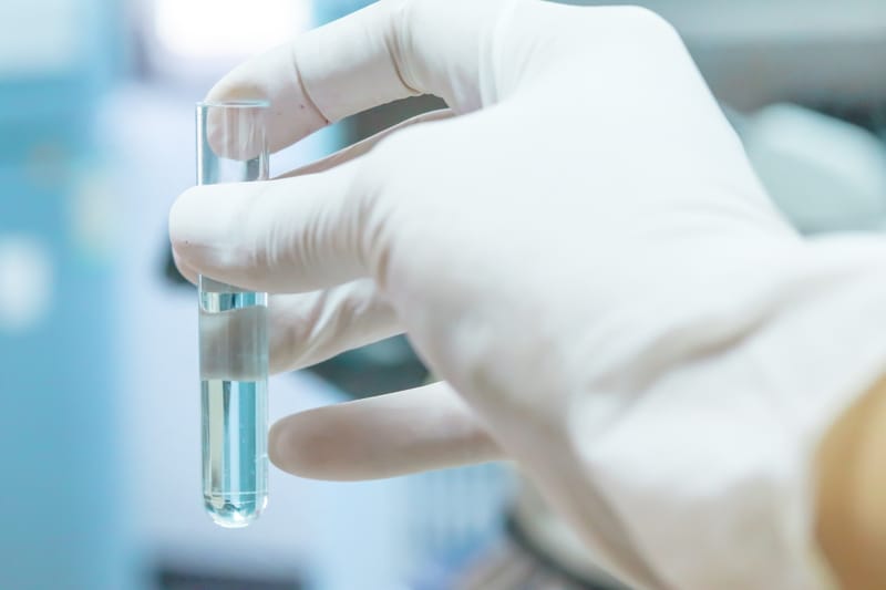 ניקוי וחיטוי מערכות מי שתיה