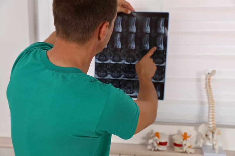 Back Pain Myths No. 2 - don't become a VOMIT (victim of medical imaging technology)