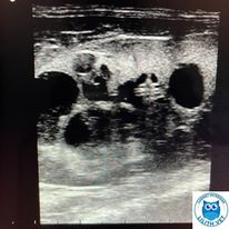 Ecografie abdominala