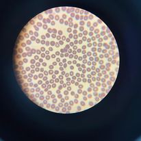 Analize de laborator