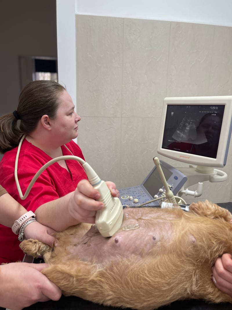 Ecografie de gestatie