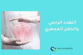 التغدد الرحمي والحقن المجهري