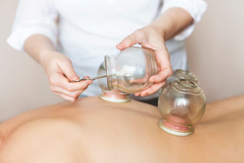 Cupping Therapy