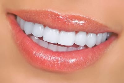 Top 10 Teeth Whitening Treatment Clinic Gurgaon