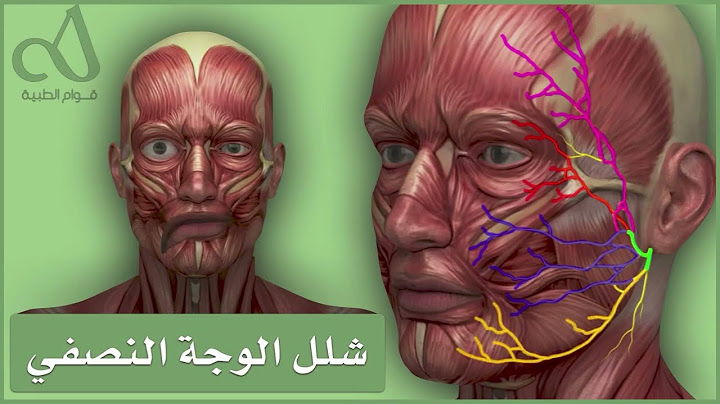 شلل الوجه النصفي
