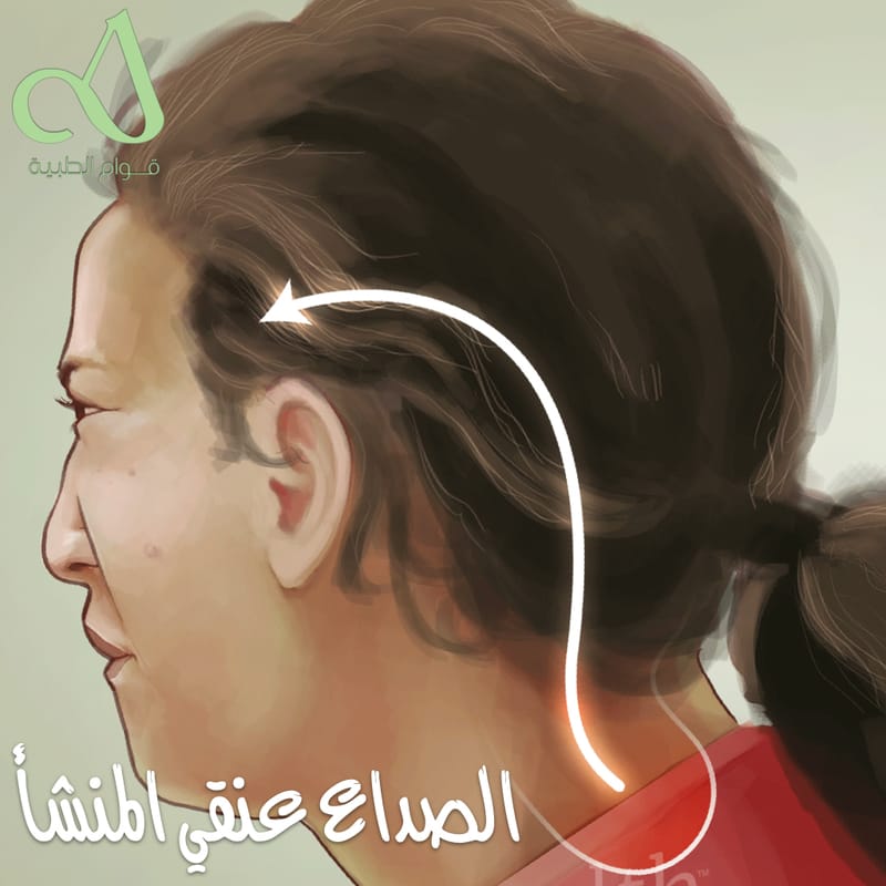 الصداع عنقي المنشأ