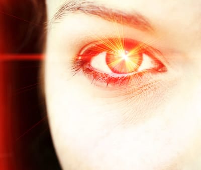 Ojos quemados por el sol