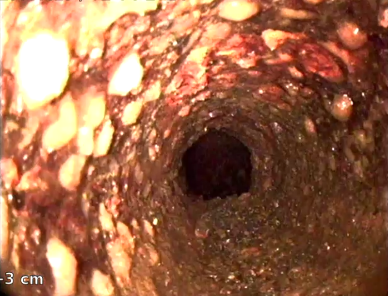 HAR DU GAMLA AVLOPPSRÖR?