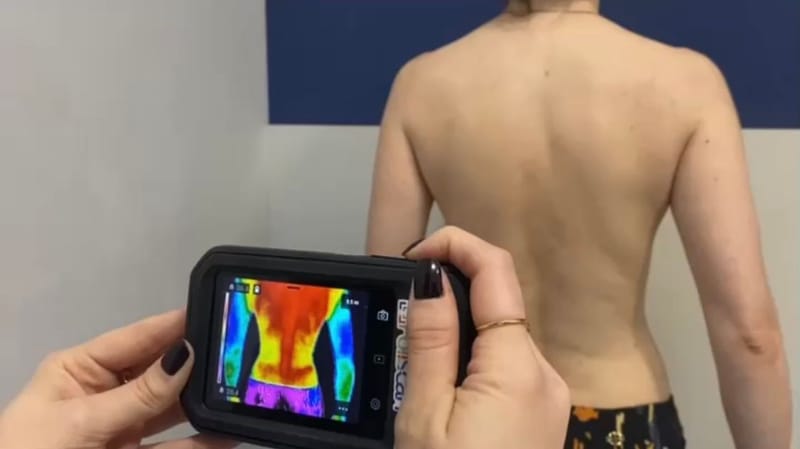 Termografia Médica Digital