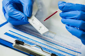 RAPID DIAGNOSTIC TESTS