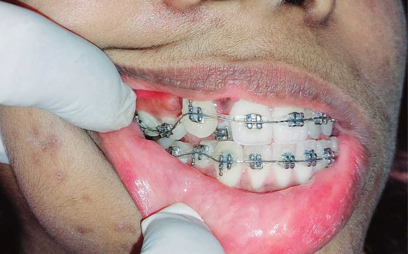 Orthodontics: