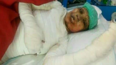 سیالکوٹ کی مسیحی لڑکی عاصمہ یقوب زخموں کی تاب نہ لاتے ھوے ہسپتال میں انتقال کر گئی