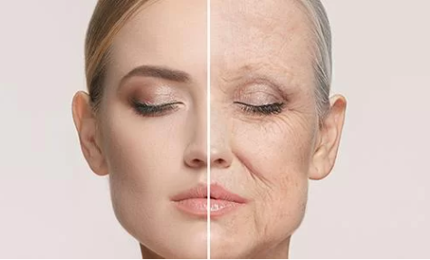 Rejuvenescimento