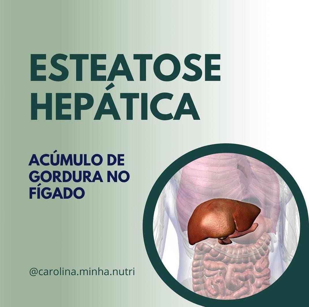 Esteatose Hepática