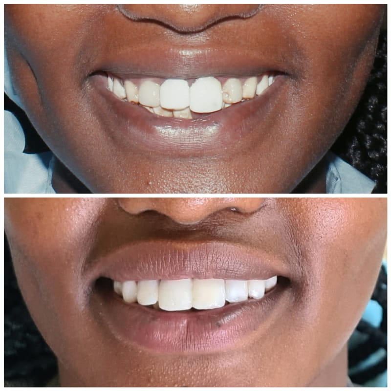 Cosmetic Dentistry