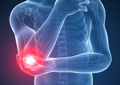 WHAT IS ELBOW JOINT  image