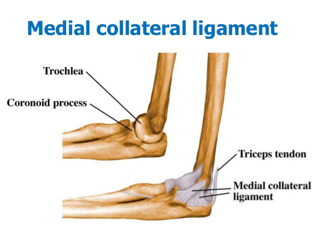 medial elbow ligament sprain