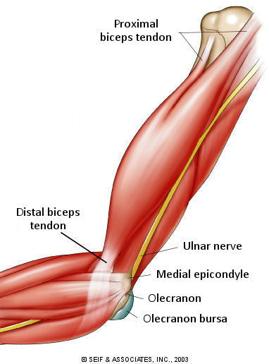 bicep tendon strain