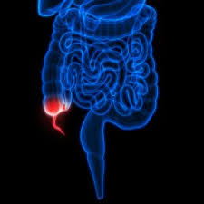 Forced Appendicitis