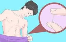 Resep Obat Kutil Kelamin 1hari Rontok