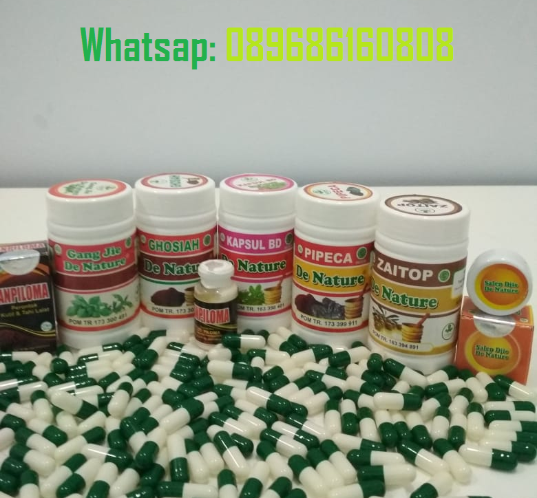 Jenis Ramuan Obat Kutil Kelamin Alami